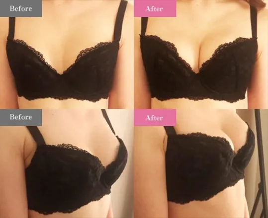 8年間で50000人のバストの悩みを解決